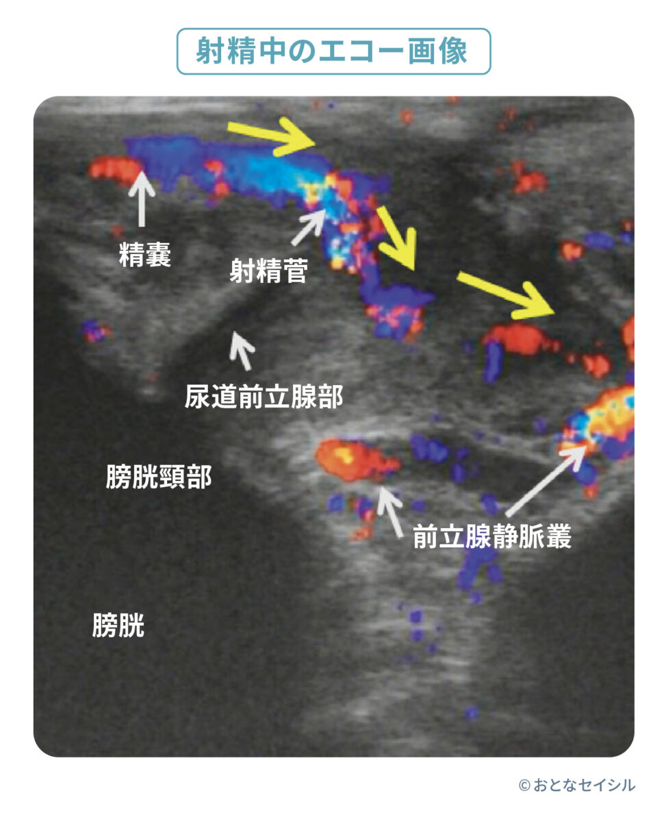 射精　エコー画像
