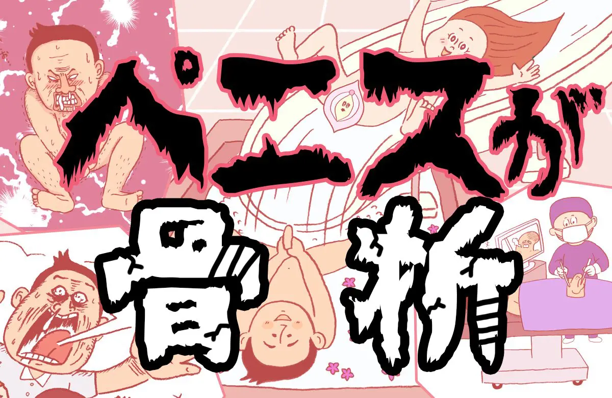 僕、ペニスが折れまして。恐怖の陰茎骨折体験談